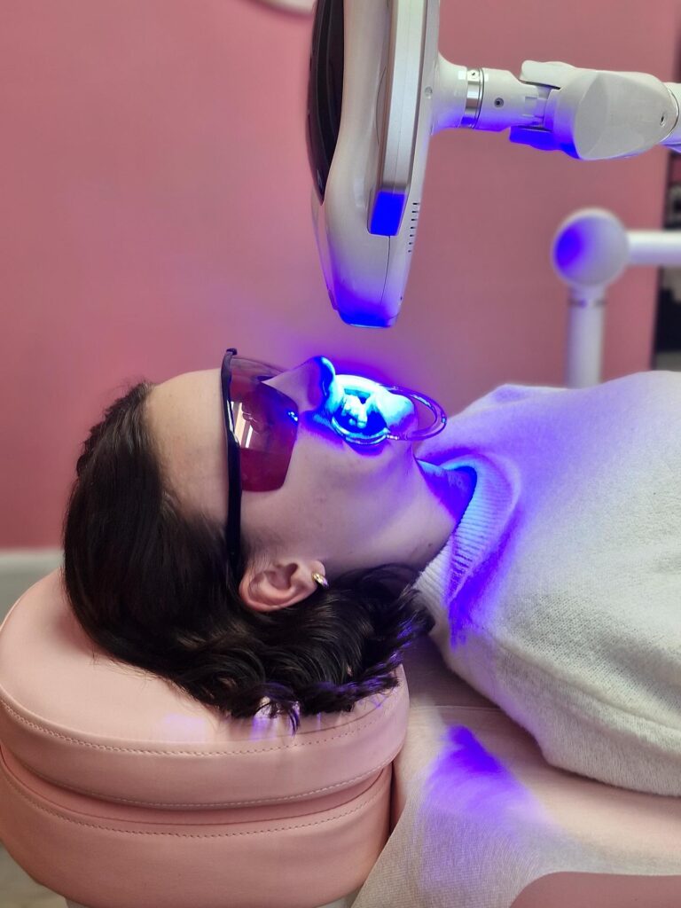 Phoebe's Beauty Parlour — Teeth Whitening